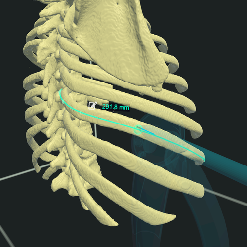 Apply tools such as measurements and anatomical inclusions