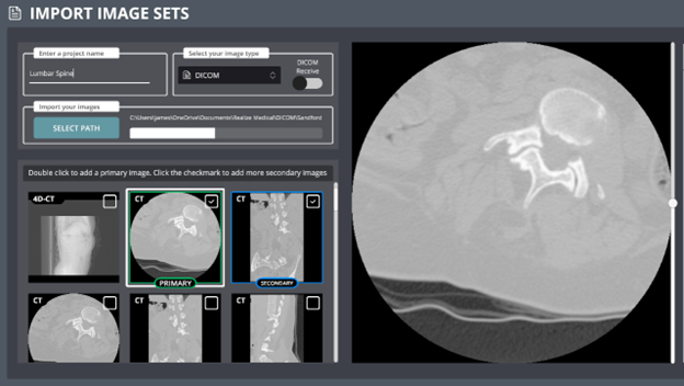 Elucis Import Image Sets dialog showing DICOM project setup with primary and secondary image thumbnails.